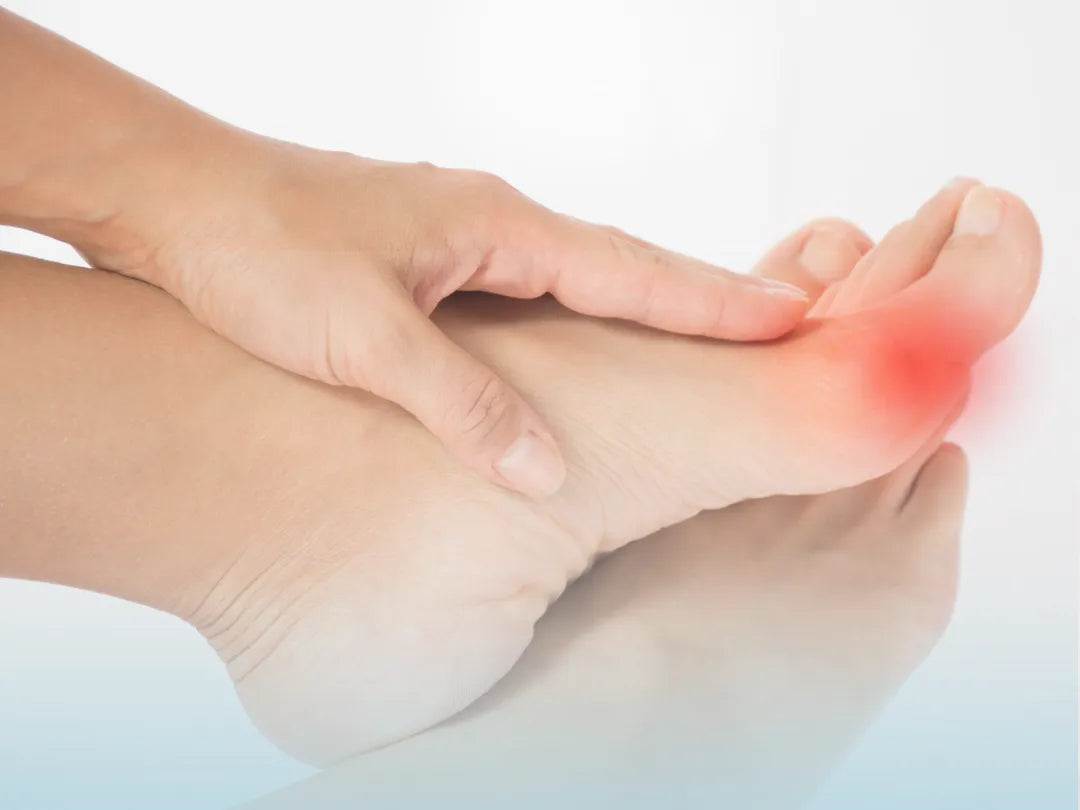 Understanding Hallux Valgus and Bunions: What Kansas City Residents Should Know