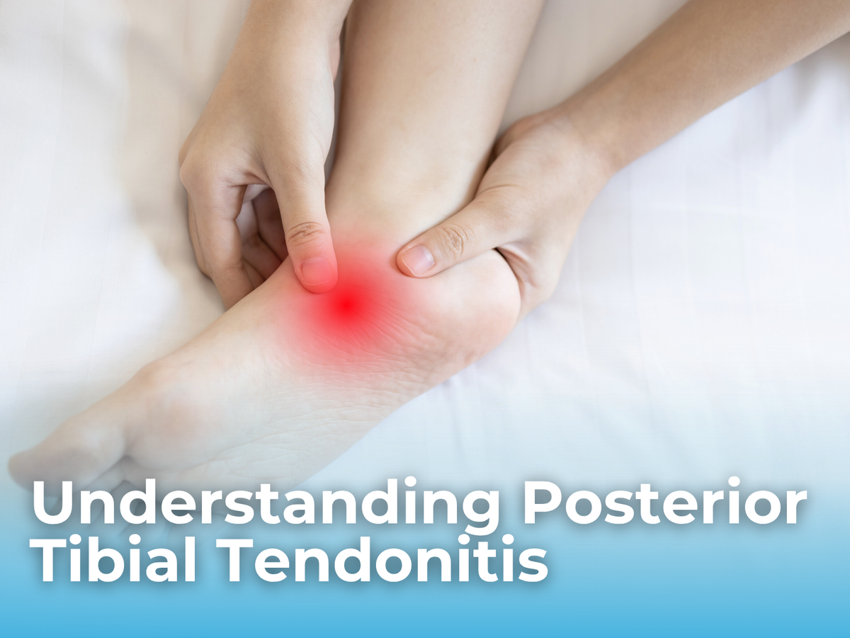 Posterior Tibial Tendonitis: Symptoms, Causes, and How Supportive Shoes Can Help